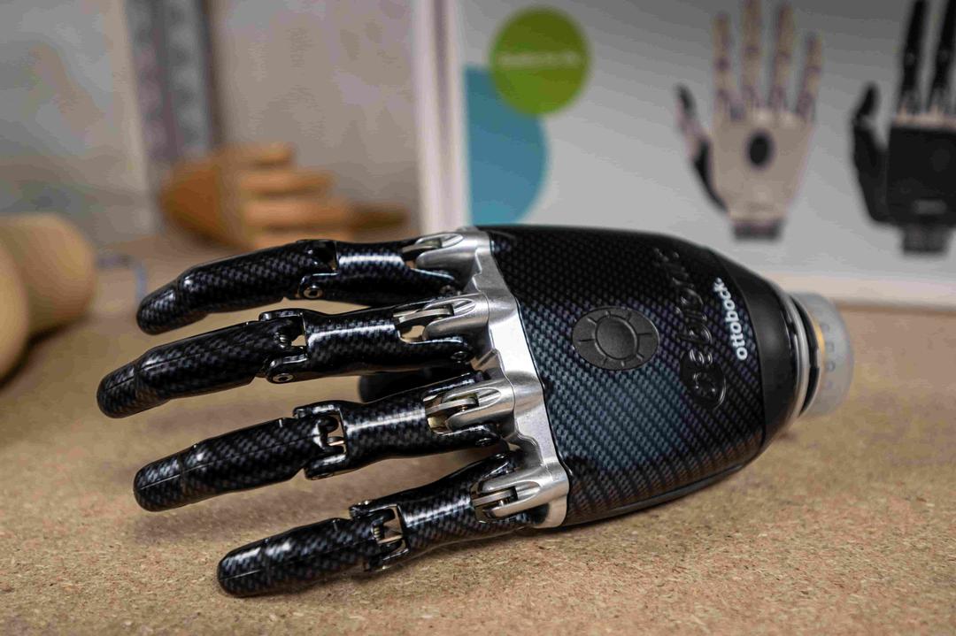 Study: New Prosthetic Hand Lets Amputee Sense Temperature