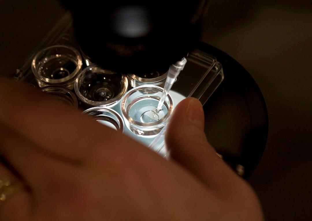 Scientists Advance Towards Making IVF Eggs From Skin Cells