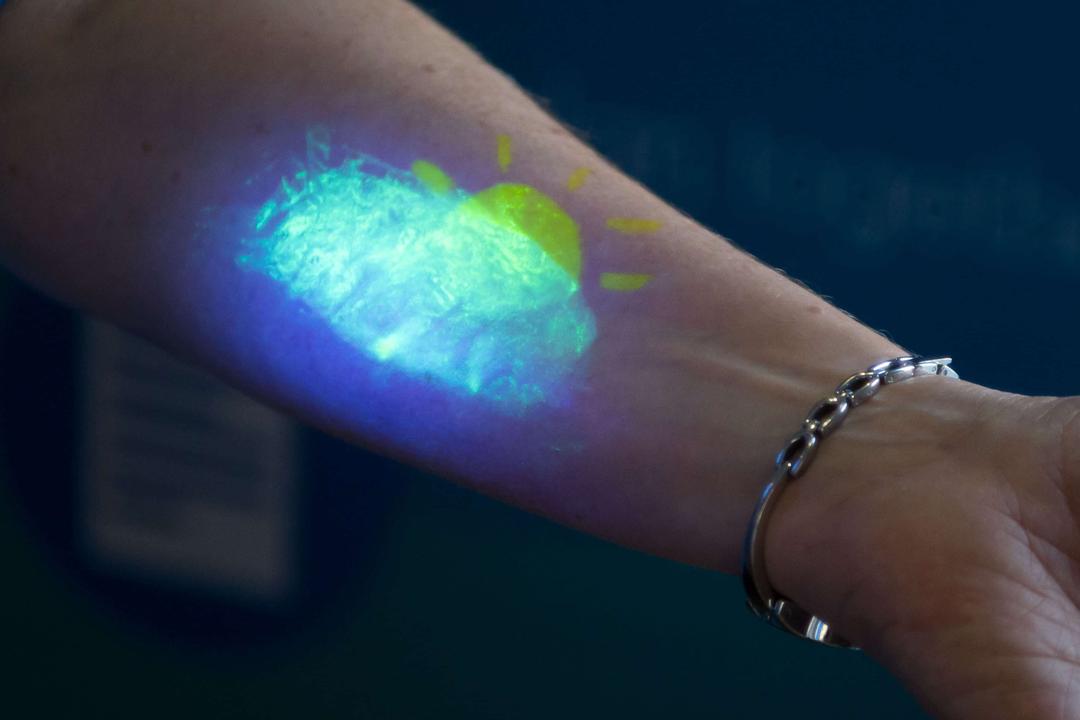Human Trials Begin for Personalized mRNA Melanoma Jabs