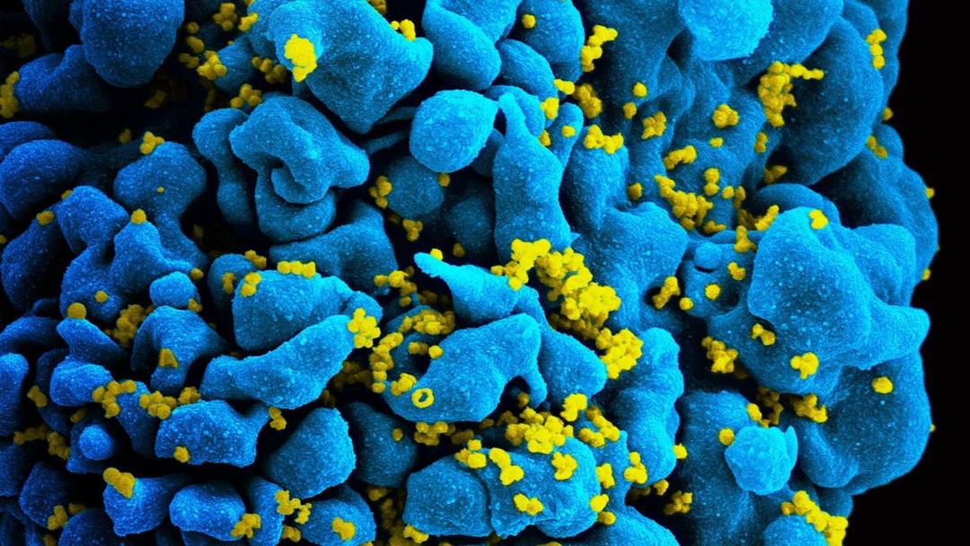 Study: mRNA Forces Hidden HIV Out of Cells