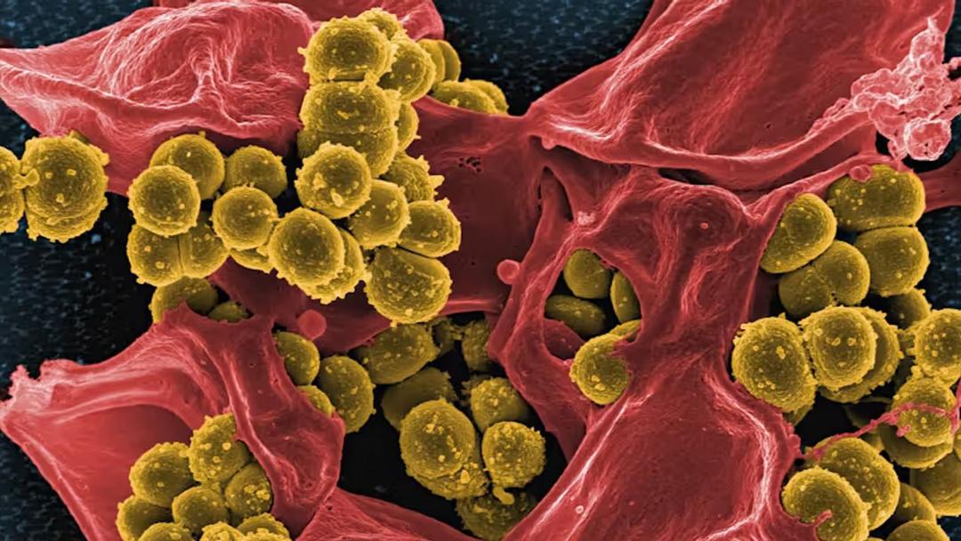 Study: Superbugs Could Cost Global Economy $1.7T by 2050