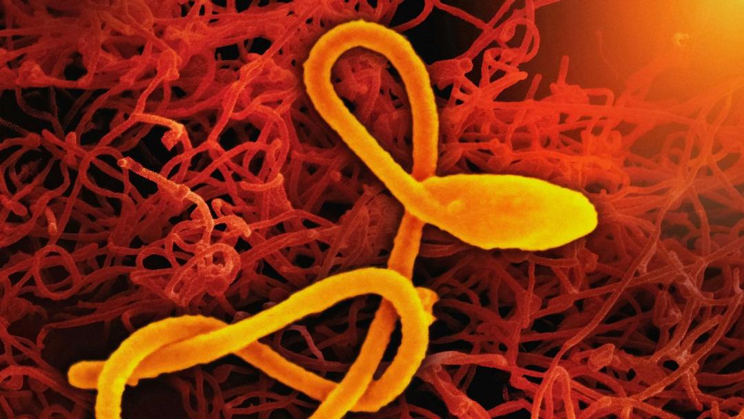 Congo Declares Ebola Outbreak: 28 Cases, 15 Deaths Reported
