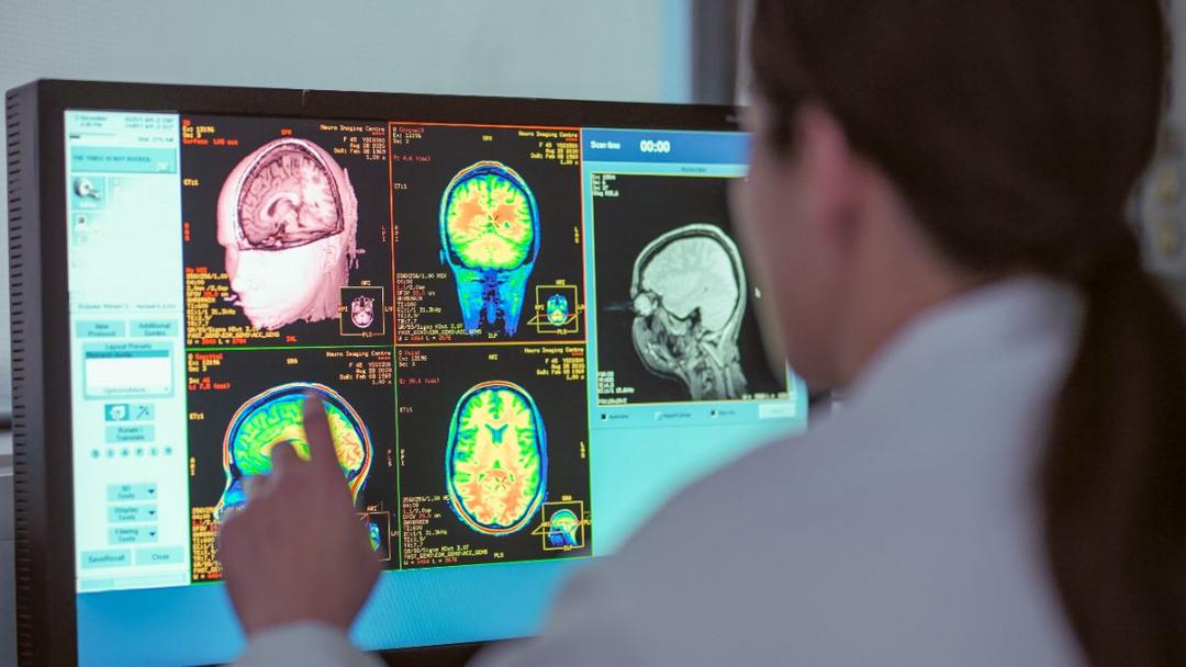 Scientists Map Brain’s 'Mileage Clock' for Distance Tracking